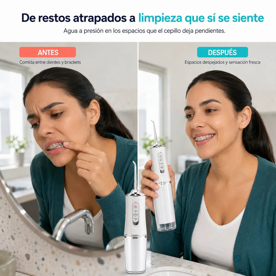 Irrigador Bucal Portátil